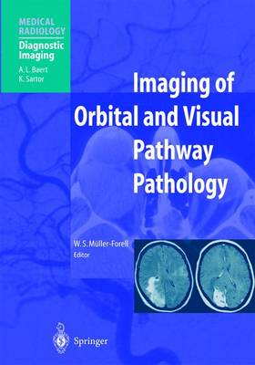 Imaging of Orbital and Visual Pathway Pathology - Muller-Forell, Wibke S (Editor), and M]ller-Forell, W S (Contributions by), and Sartor, K (Foreword by)