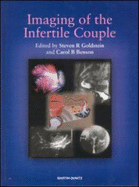 Imaging of the Infertile Couple - Benson, Carol B, MD (Editor), and Goldstein, Steven R, MD (Editor)