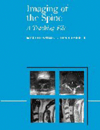 Imaging of the Spine: A Teaching File - Castillo, Mauricio, MD, and Harris, John H, Jr., MD, Dsc