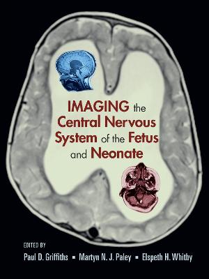 Imaging the Central Nervous System of the Fetus and Neonate - Griffiths, Paul D (Editor), and Paley, Martyn N J (Editor), and Whitby, Elspeth H (Editor)