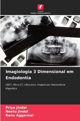 Imagiologia 3 Dimensional em Endodontia - Jindal, Priya, and Jindal, Neetu, and Aggarwal, Renu