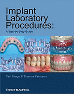 Implant Laboratory Procedures: A Step-By-Step Guide