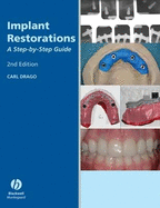 Implant Restorations: A Step-By-Step Guide - Drago, Carl, and Peterson, Thomas