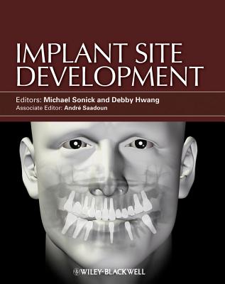 Implant Site Development - Sonick, Michael (Editor), and Hwang, Debby (Editor)