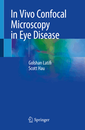 In Vivo Confocal Microscopy in Eye Disease