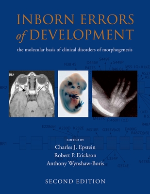 Inborn Errors of Development - Epstein, Charles J, and Erickson, Robert P, and Wynshaw-Boris, Anthony