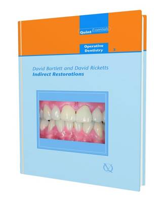 Indirect Restorations - Bartlett, David