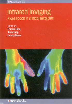 Infrared Imaging: A casebook in clinical medicine - Ring, Francis (Editor), and Jung, Anna (Editor), and Zuber, Janusz (Editor)