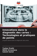 Innovations dans le diagnostic des caries: Technologies et pratiques de pointe