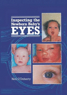 Inspecting the Newborn Baby's Eyes - O'Doherty, Neil