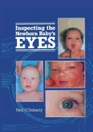 Inspecting the Newborn Baby's Eyes - O'Doherty, N.