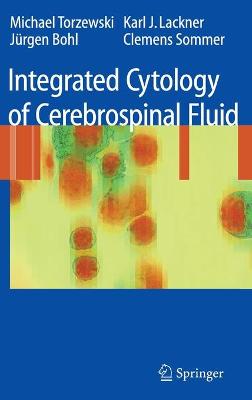 Integrated Cytology of Cerebrospinal Fluid - Torzewski, Michael, and Lackner, Karl J, and Bohl, Jrgen