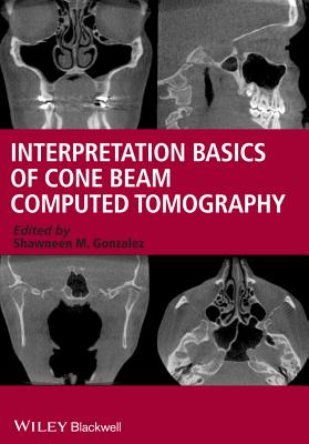 Interpretation Basics of Cone Beam Computed Tomography - Gonzalez, Shawneen M