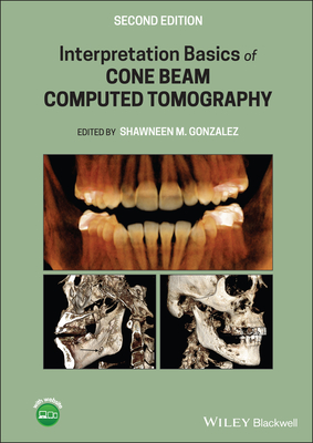 Interpretation Basics of Cone Beam Computed Tomography - Gonzalez, Shawneen M. (Editor)