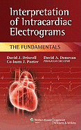 Interpretation of Intracardiac Electrograms: The Fundamentals