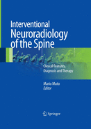 Interventional Neuroradiology of the Spine: Clinical Features, Diagnosis and Therapy