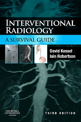 Interventional Radiology: a Survival Guide - Kessel, David, and Robertson, Iain