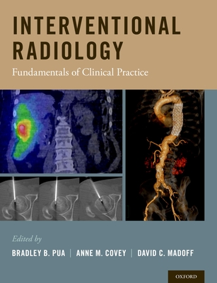 Interventional Radiology: Fundamentals of Clinical Practice - Pua, Bradley B. (Editor), and Covey, Anne M. (Editor), and Madoff, David C. (Editor)