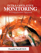 Intra-Operative Monitoring: A Comprehensive Approach