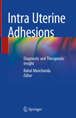 Intra Uterine Adhesions: Diagnostic and Therapeutic Insight - Manchanda, Rahul (Editor)