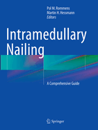 Intramedullary Nailing: A Comprehensive Guide