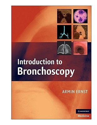 Introduction to Bronchoscopy - Ernst, Armin (Editor)