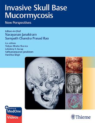 Invasive Skull Base Mucormycosis: New Perspectives - Janakiram, Narayanan (Editor), and Prasad Rao, Sampath (Editor)