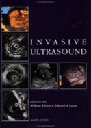 Invasive ultrasound