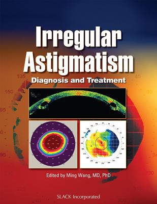 Irregular Astigmatism: Diagnosis and Treatment - Wang, Ming, MD