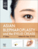 Asian Blepharoplasty and the Eyelid Crease With Access Code 4ed (Hb 2025)