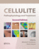 Cellulite: Pathophysiology and Treatment (Basic and Clinical Dermatology)