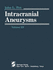 Intracranial Aneurysms: 3