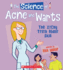 The Science of Acne and Warts: the Itchy Truth About Skin (the Science of the Body)