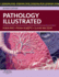 Pathology Illustrated