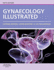 Pathology Illustrated