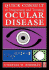 Quick Consult to Diagnosing and Treating Ocular Disease
