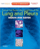 Tumors and Tumor-Like Conditions of the Lung and Pleura: Expert Consult: Online and Print