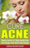 Cure Acne: Beauty Secrets For Silky-Smooth Skin - Look Younger, Clear Skin & Acne Remedy