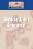 D&D: Sickle Cell Disease Fc