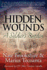 Hidden Wounds: a Soldier's Burden