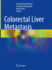 Colorectal Liver Metastasis (Hb 2022)