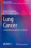 Lung Cancer a Comprehensive Guide for the Clinician (Hb 2023)