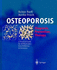 Osteoporosis: Diagnosis, Prevention, Therapy: a Practical Guide for All Physicians-From Pediatrics to Geriatrics