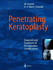 Penetrating Keratoplasty