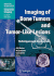 Imaging of Bone Tumors and Tumor-Like Lesions: Techniques and Applications