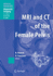 Mri and Ct of the Female Pelvis