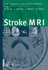 Stroke Mri