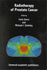 Radiotherapy of Prostate Cancer