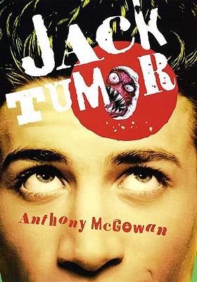 Jack Tumor - McGowan, Anthony