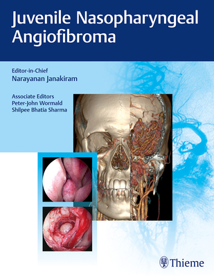 Juvenile Nasopharyngeal Angiofibroma - Janakiram, Narayanan (Editor), and Wormald, Peter-John, and Sharma, Shilpee Bhatia